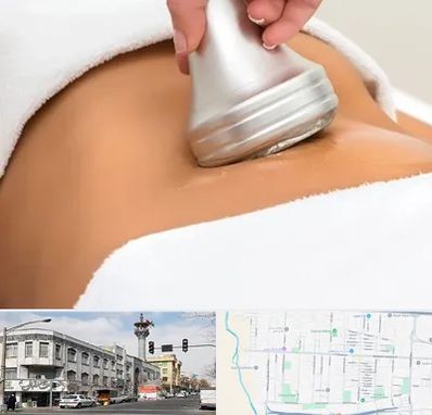 دستگاه لاغری در 17شهریور