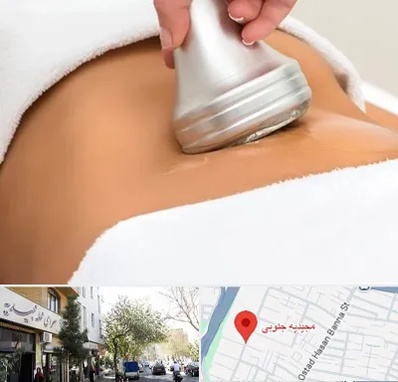 دستگاه لاغری در مجیدیه جنوبی