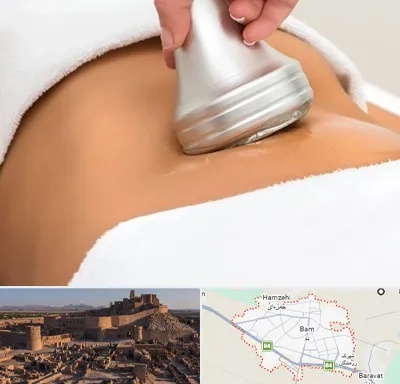 دستگاه لاغری در بم