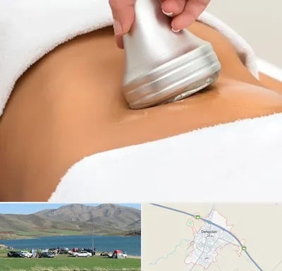 دستگاه لاغری در دهگلان
