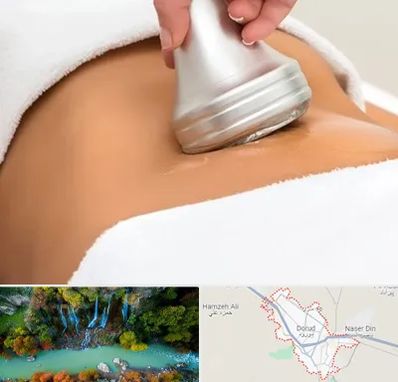 دستگاه لاغری در دورود