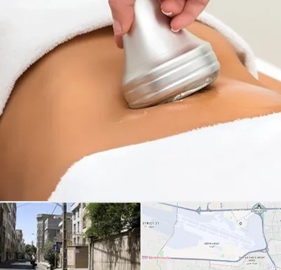 دستگاه لاغری در مهرآباد