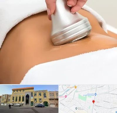 دستگاه لاغری در زنبیل آباد قم