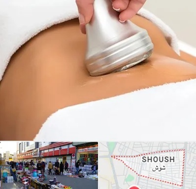 دستگاه لاغری در شوش