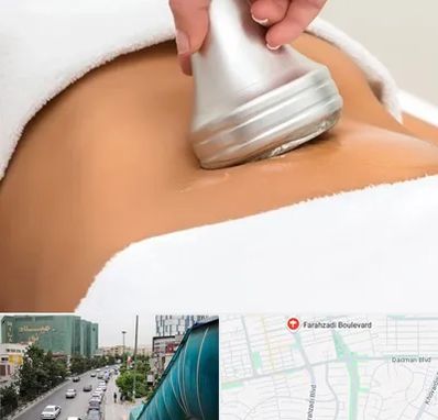 دستگاه لاغری در بلوار فرحزادی