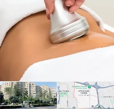 دستگاه لاغری در آپادانا