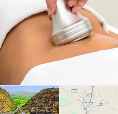 دستگاه لاغری در کامیاران