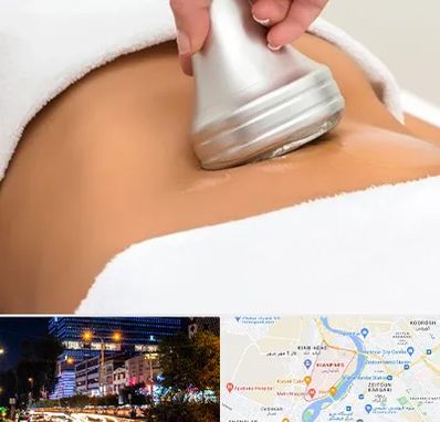 دستگاه لاغری در کیانپارس اهواز 