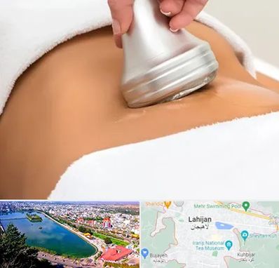 دستگاه لاغری در لاهیجان