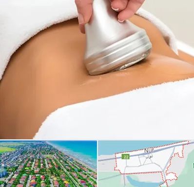 دستگاه لاغری در نور