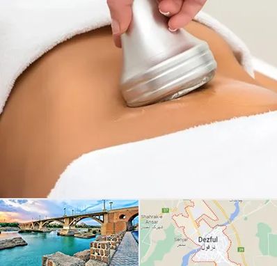 دستگاه لاغری در دزفول