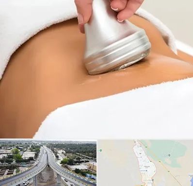 دستگاه لاغری در اندیمشک