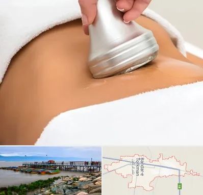 دستگاه لاغری در بندر ترکمن