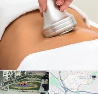 دستگاه لاغری در مرزداران تبریز