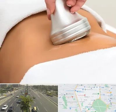 دستگاه لاغری در منطقه 17 تهران 