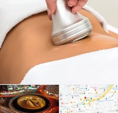 دستگاه لاغری در میدان ولیعصر 