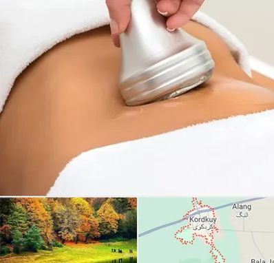 دستگاه لاغری در کردکوی