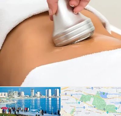 دستگاه لاغری در چیتگر 