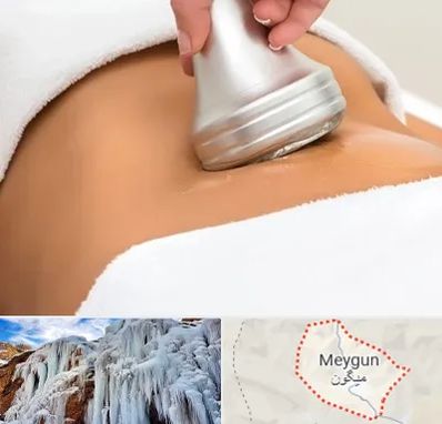 دستگاه لاغری در میگون