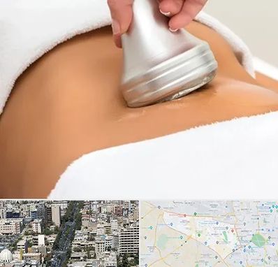 دستگاه لاغری در منطقه 18 تهران 