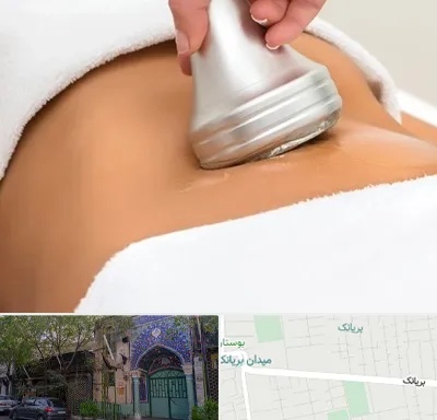 دستگاه لاغری در بریانک