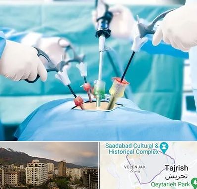 جراح فیبروم در زعفرانیه