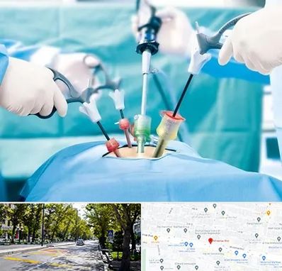 جراح فیبروم در میرداماد