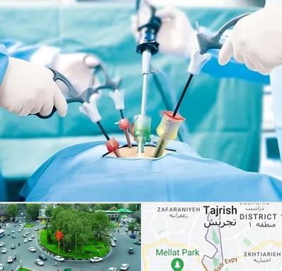 جراح فیبروم در تجریش