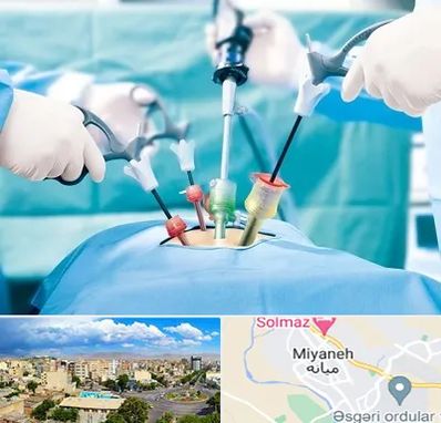 جراح فیبروم در میانه