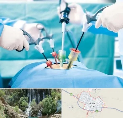 جراح فیبروم در شیروان