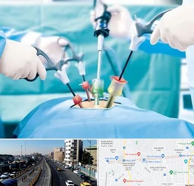 جراح فیبروم در پیروزی