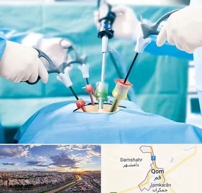 جراح فیبروم در قم