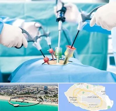 جراح فیبروم در کیش