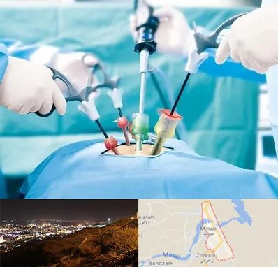 جراح فیبروم در میناب