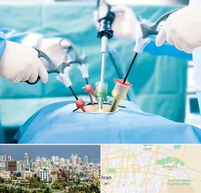 جراح فیبروم در شرق تهران