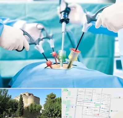 جراح فیبروم در مرداویج اصفهان