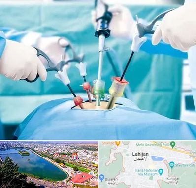 جراح فیبروم در لاهیجان