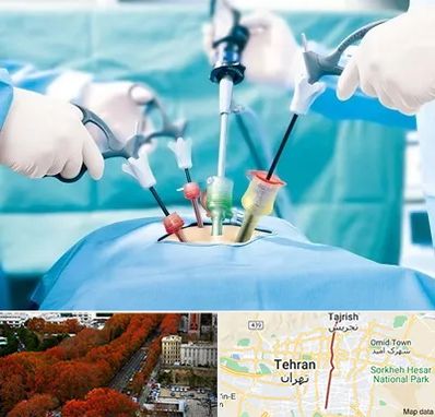 جراح فیبروم در ولیعصر