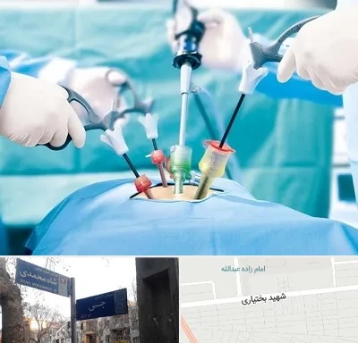 جراح فیبروم در سی متری جی