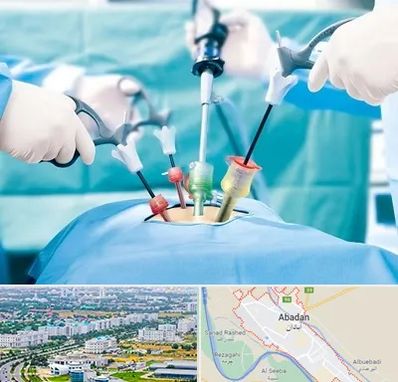 جراح فیبروم در آبادان