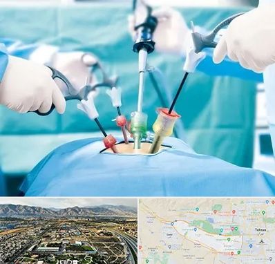 جراح فیبروم در منطقه 21 تهران