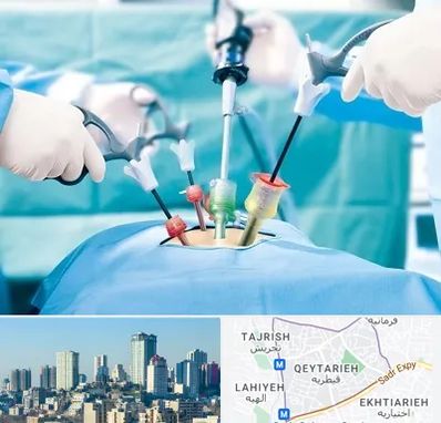 جراح فیبروم در قیطریه