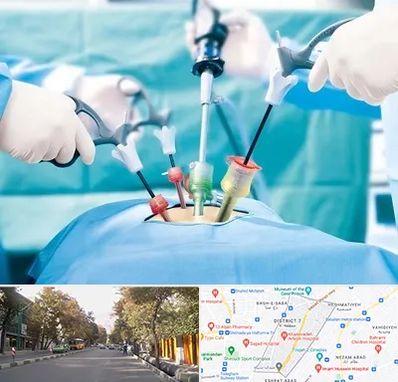 جراح فیبروم در شریعتی