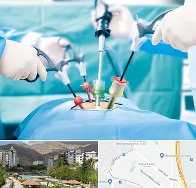 جراح فیبروم در شهر زیبا