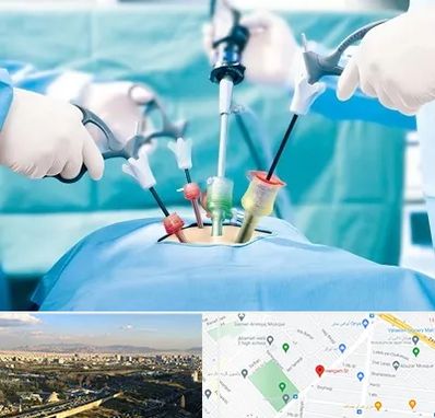 جراح فیبروم در هنگام