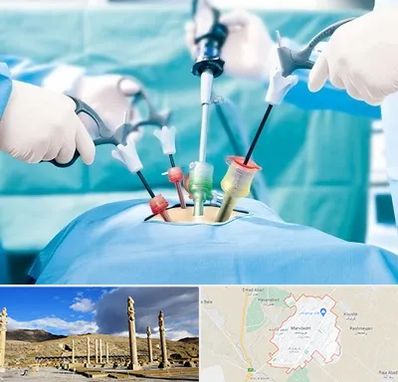 جراح فیبروم در مرودشت