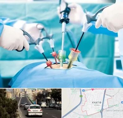 جراح فیبروم در خطیب تبریز