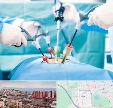 جراح فیبروم در سهند تبریز