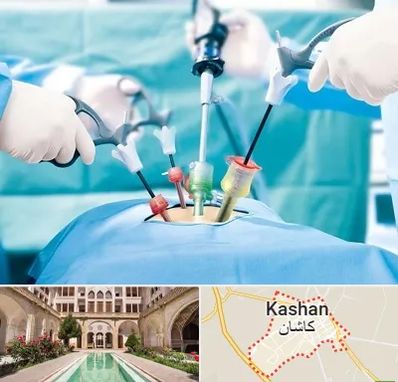 جراح فیبروم در کاشان