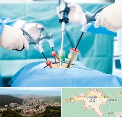 جراح فیبروم در گرگان